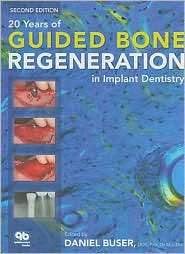 20 Years of Guided Bone Regeneration in Implant Dentistry, (0867154012 