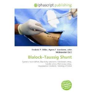  Blalock Taussig Shunt (9786134075923) Frederic P. Miller 