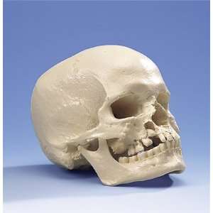  Microcephalic Skull 