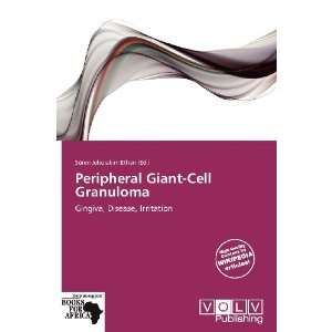   Giant Cell Granuloma (9786138862383) Sören Jehoiakim Ethan Books