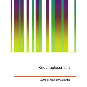  Knee replacement Ronald Cohn Jesse Russell Books