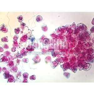Balantidium coli Cysts, smear Microscope Slide  Industrial 