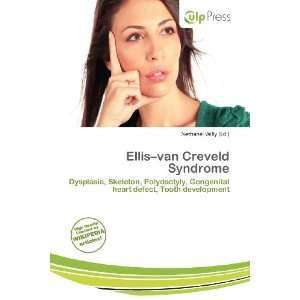  Ellis van Creveld Syndrome (9786200838346) Nethanel Willy Books