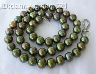 Amazing 20 RARE 10mm Aerugo round freshwater pearls necklace  