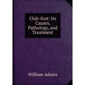  Club foot Its Causes, Pathology, and Treatment William 