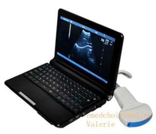   Digital Laptop Ultrasound Scanner/machine +Convex Probe RUS 9000F